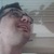 Surdoped